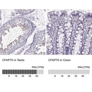 Merck Anti-CFAP70