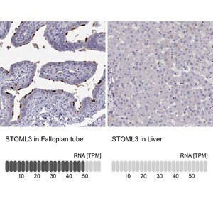 Merck Anti-STOML3