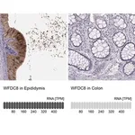 Merck Anti-WFDC8