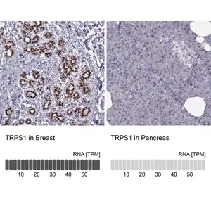 Merck Anti-TRPS1