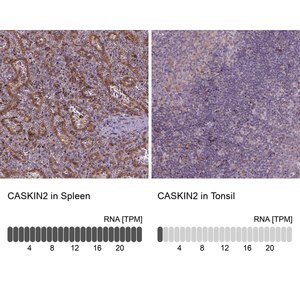 Merck Anti-CASKIN2