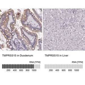 Merck Anti-TMPRSS15