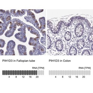 Merck Anti-PIH1D3