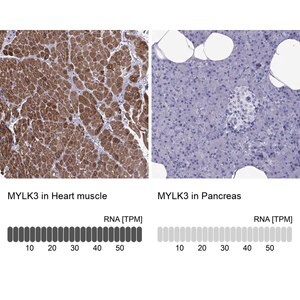 Merck Anti-MYLK3