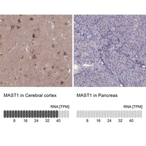 Merck Anti-MAST1