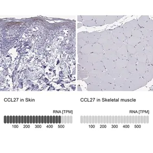 Merck Anti-CCL27