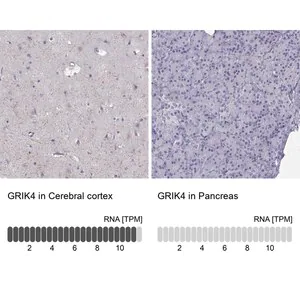 Merck Anti-GRIK4