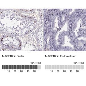 Merck Anti-MAGEB2