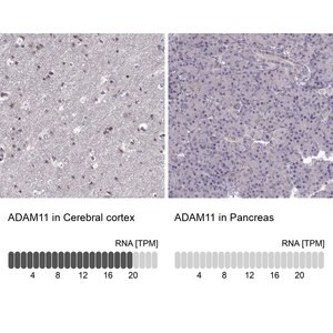 Merck Anti-ADAM11