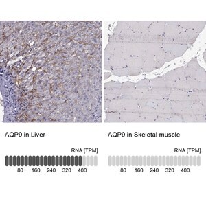 Merck Anti-AQP9