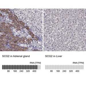 Merck Anti-SCG2