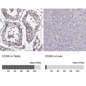 Merck Anti-CCNK