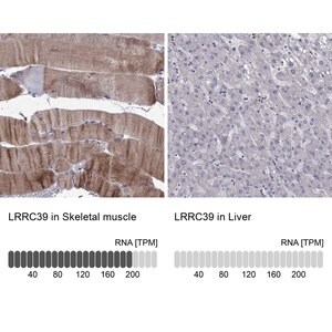 Merck Anti-LRRC39