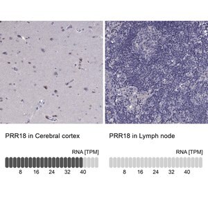 Merck Anti-PRR18