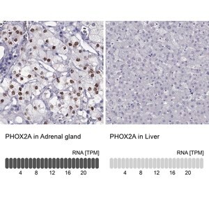 Merck Anti-PHOX2A