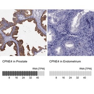 Merck Anti-CPNE4
