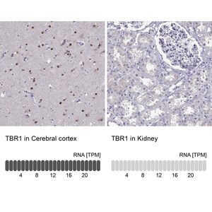 Merck Anti-TBR1