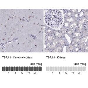 Merck Anti-TBR1