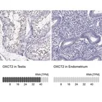 Merck Anti-OXCT2
