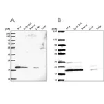 Merck Anti-NDUFAF2 antibody produced in rabbit