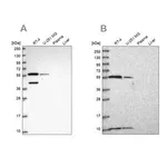 Merck Anti-NUP50 antibody produced in rabbit