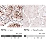 Merck Monoclonal Anti-METTL14 antibody produced in mouse