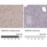 Merck Anti-TMEM145 antibody produced in rabbit