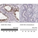 Merck Anti-CCDC136 antibody produced in rabbit