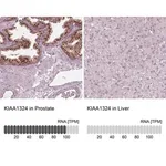 Merck Anti-KIAA1324 antibody produced in rabbit