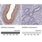 Merck Anti-ADGRG2 antibody produced in rabbit