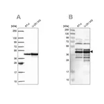 Merck Anti-SLBP antibody produced in rabbit