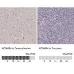 Merck Anti-KCNMB4 antibody produced in rabbit