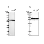 Merck Anti-CCDC47 antibody produced in rabbit