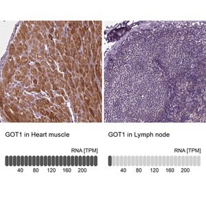 Merck Anti-GOT1 antibody produced in rabbit