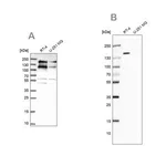 Merck Anti-TOP2B antibody produced in rabbit