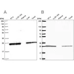 Merck Anti-TPI1 antibody produced in rabbit