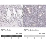 Merck Anti-TEPP antibody produced in rabbit
