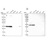 Merck Anti-NOSIP antibody produced in rabbit