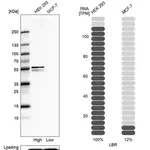 Merck Anti-LBR antibody produced in rabbit