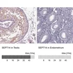 Merck Anti-SEPT14 antibody produced in rabbit
