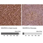 Merck Anti-NDUFB10 antibody produced in rabbit