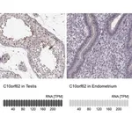 Merck Anti-C10orf62 antibody produced in rabbit