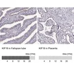 Merck Anti-KIF19 antibody produced in rabbit