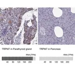 Merck Anti-TRPM7 antibody produced in rabbit