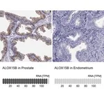 Merck Anti-ALOX15B antibody produced in rabbit
