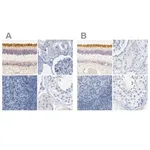 Merck Anti-OPN1SW antibody produced in rabbit