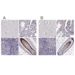 Merck Anti-TCHHL1 antibody produced in rabbit