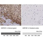 Merck Anti-AKR1B1 antibody produced in rabbit