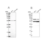 Merck Anti-COQ8B antibody produced in rabbit