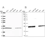 Merck Anti-TPI1 antibody produced in rabbit